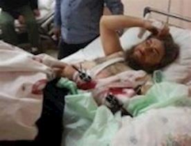 Türkiyə-xəstəxanaları-İŞİD-yaralılarının-müalicə-məkanıdır